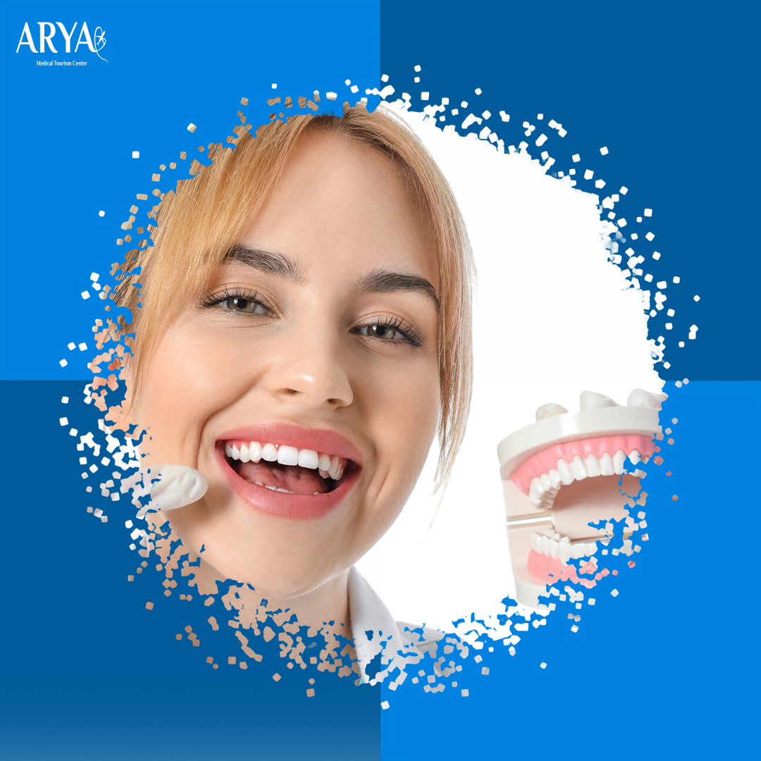 زراعة الأسنان